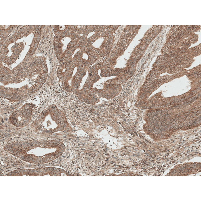 Immunohistochemistry - Anti-Bcl-2 Antibody (A305144) - Antibodies.com