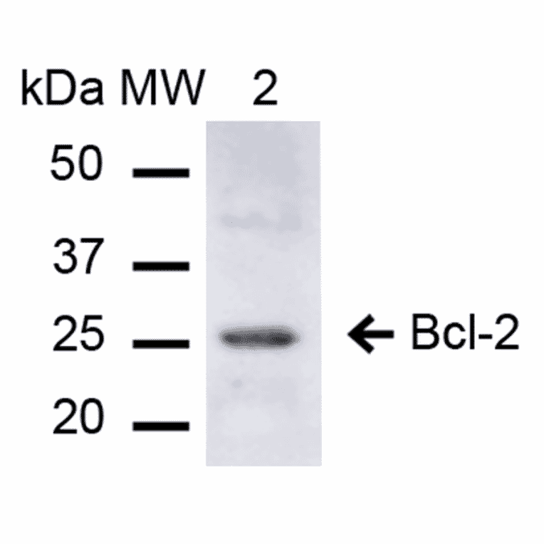 Western Blot - Anti-Bcl-2 Antibody (A305144) - Antibodies.com