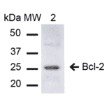 Western Blot - Anti-Bcl-2 Antibody (A305144) - Antibodies.com