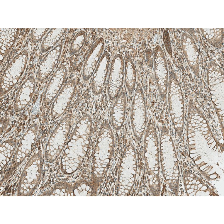 Immunohistochemistry - Anti-Bcl-2 Antibody (A305144) - Antibodies.com