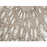 Immunohistochemistry - Anti-Bcl-2 Antibody (A305144) - Antibodies.com