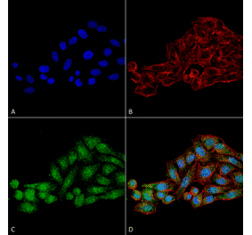 Immunocytochemistry/Immunofluorescence - Anti-WDR45 Antibody (A305145) - Antibodies.com