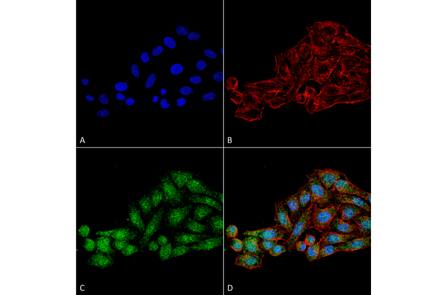 Immunocytochemistry/Immunofluorescence - Anti-WDR45 Antibody (A305145) - Antibodies.com
