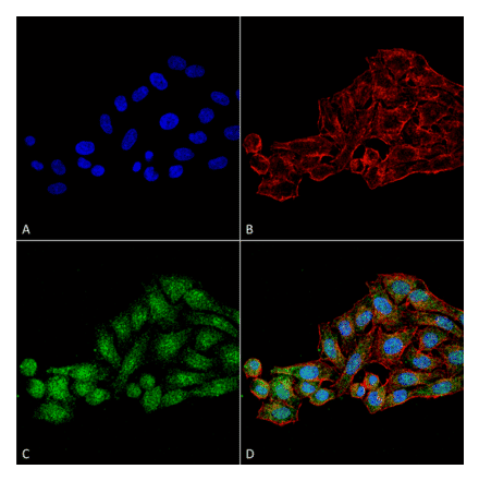 Immunocytochemistry/Immunofluorescence - Anti-WDR45 Antibody (A305145) - Antibodies.com