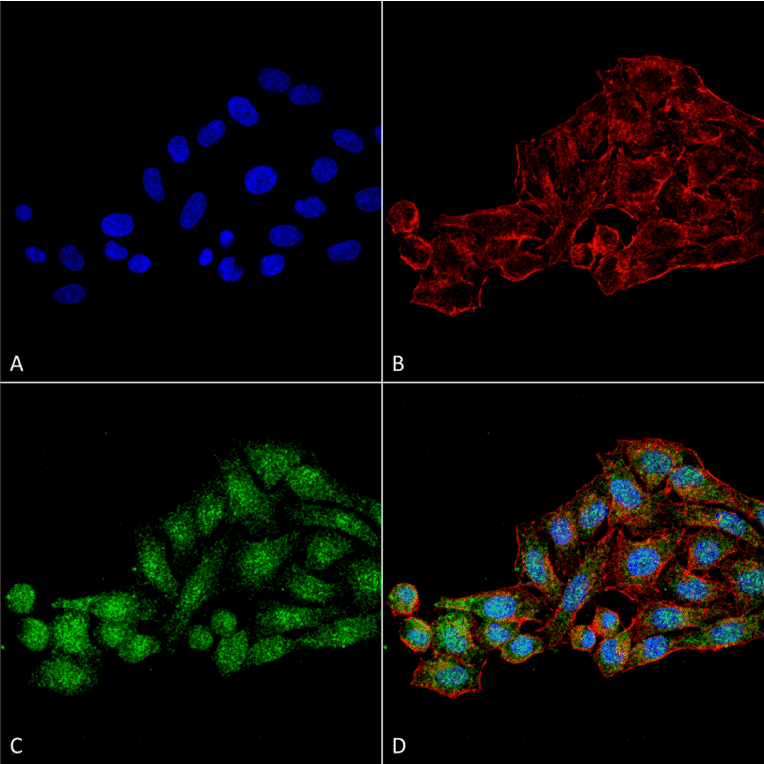 Immunocytochemistry/Immunofluorescence - Anti-WDR45 Antibody (A305145) - Antibodies.com