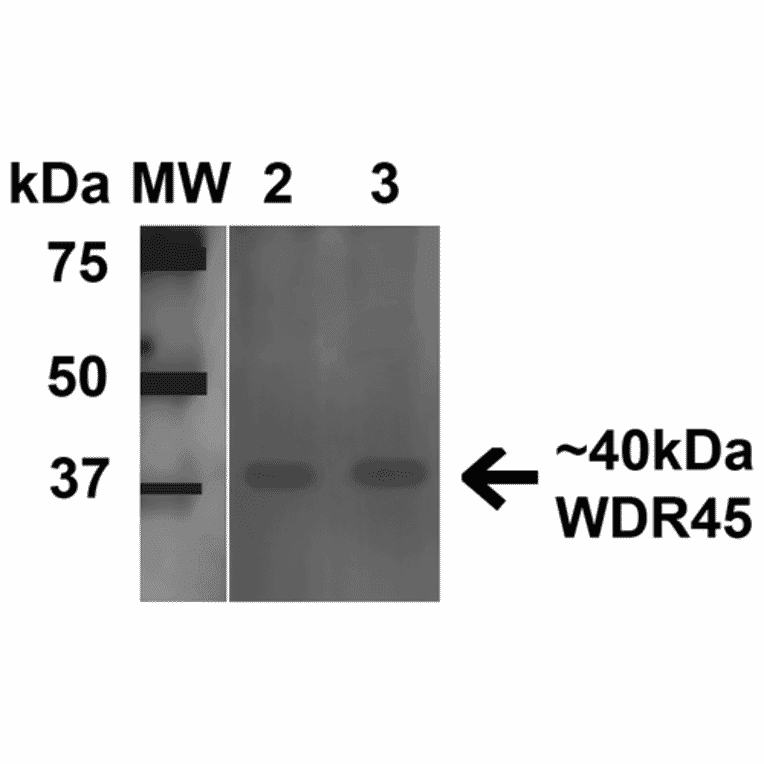 Western Blot - Anti-WDR45 Antibody (A305145) - Antibodies.com