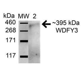 Western Blot - Anti-WDFY3 Antibody (A305146) - Antibodies.com