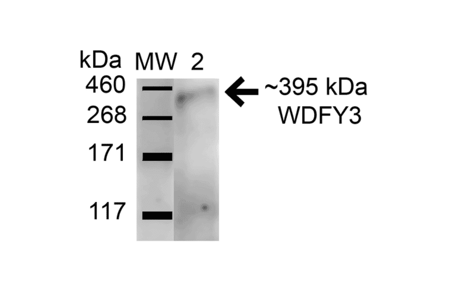 Western Blot - Anti-WDFY3 Antibody (A305146) - Antibodies.com