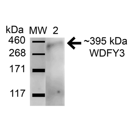 Western Blot - Anti-WDFY3 Antibody (A305146) - Antibodies.com