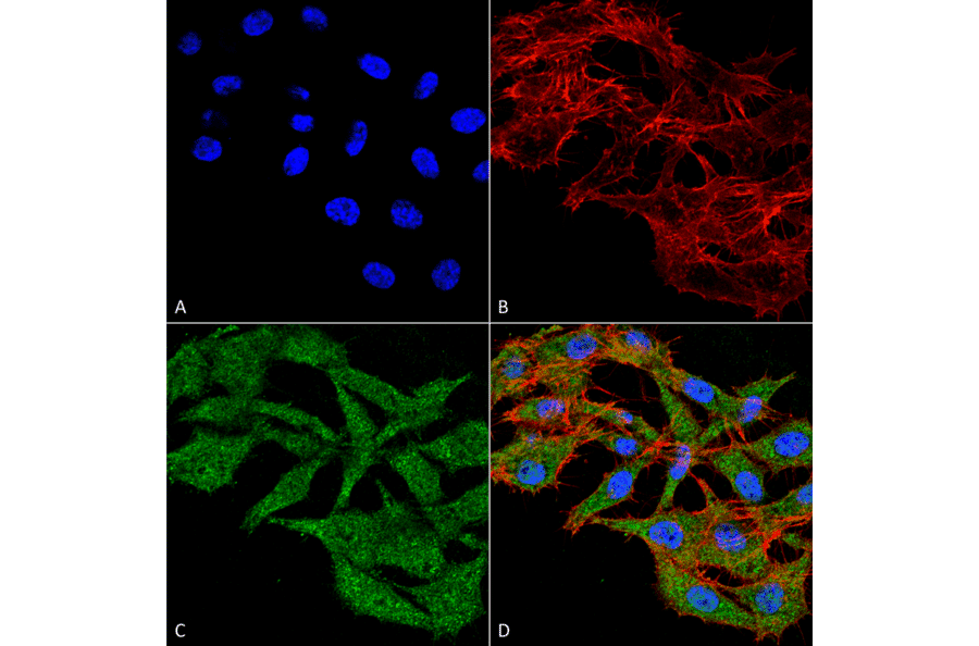 Immunocytochemistry/Immunofluorescence - Anti-WDFY3 Antibody (A305146) - Antibodies.com