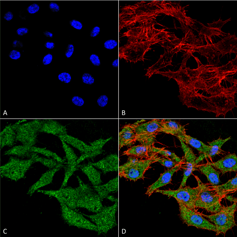 Immunocytochemistry/Immunofluorescence - Anti-WDFY3 Antibody (A305146) - Antibodies.com