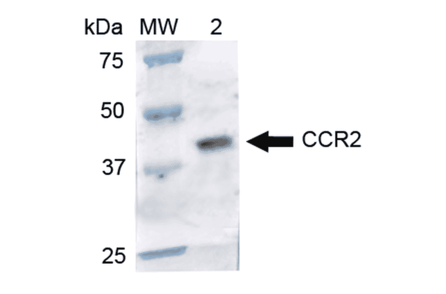 Western Blot - Anti-CCR2 Antibody (A305147) - Antibodies.com