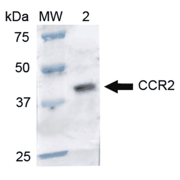 Western Blot - Anti-CCR2 Antibody (A305147) - Antibodies.com