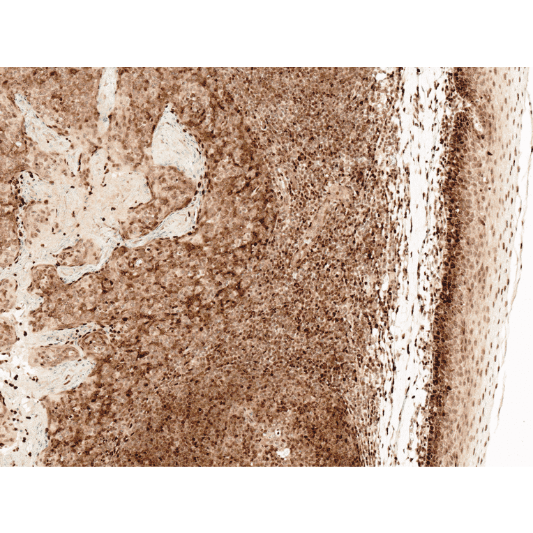 Immunohistochemistry - Anti-CCR2 Antibody (A305147) - Antibodies.com