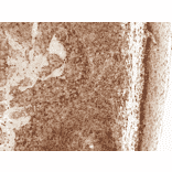 Immunohistochemistry - Anti-CCR2 Antibody (A305147) - Antibodies.com