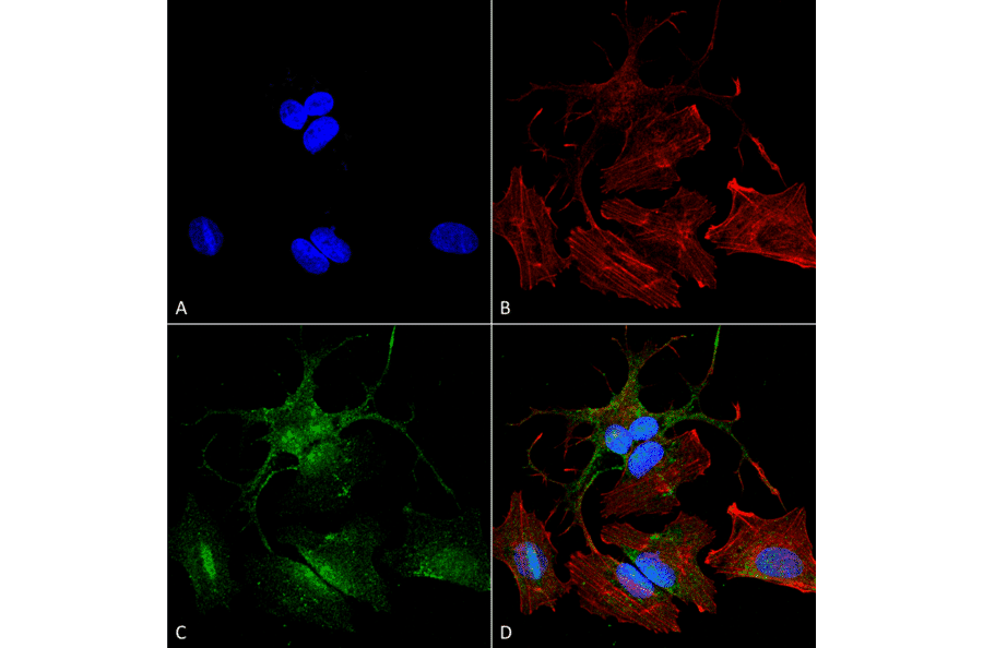 Immunocytochemistry/Immunofluorescence - Anti-Beclin 2 Antibody (A305148) - Antibodies.com