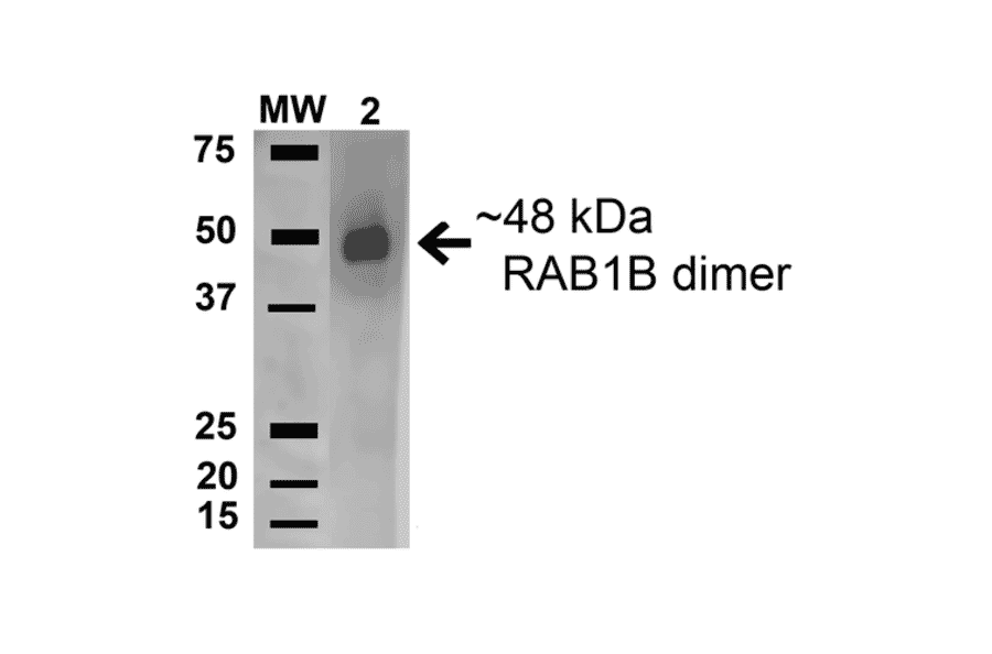 Western Blot - Anti-Rab1B Antibody (A305149) - Antibodies.com