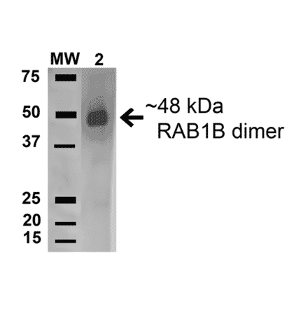 Western Blot - Anti-Rab1B Antibody (A305149) - Antibodies.com