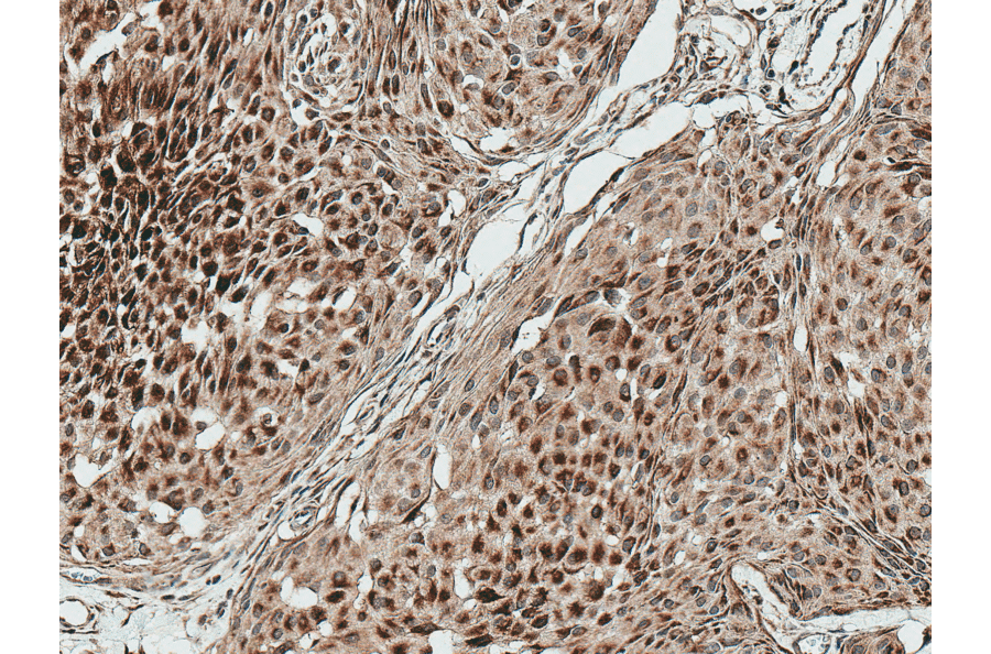 Immunohistochemistry - Anti-HSF2 Antibody (A305151) - Antibodies.com