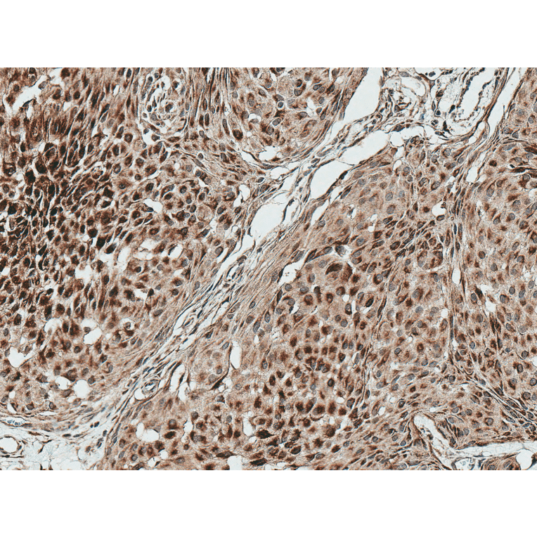 Immunohistochemistry - Anti-HSF2 Antibody (A305151) - Antibodies.com