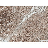 Immunohistochemistry - Anti-HSF2 Antibody (A305151) - Antibodies.com