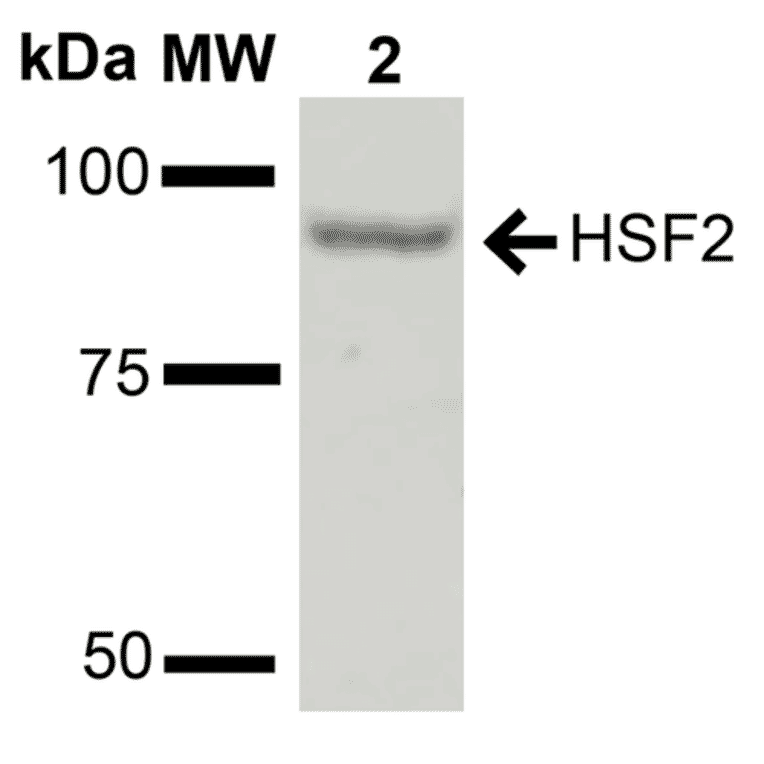 Western Blot - Anti-HSF2 Antibody (A305151) - Antibodies.com