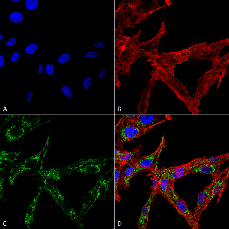 Immunocytochemistry/Immunofluorescence - Anti-HSF2 Antibody (A305151) - Antibodies.com