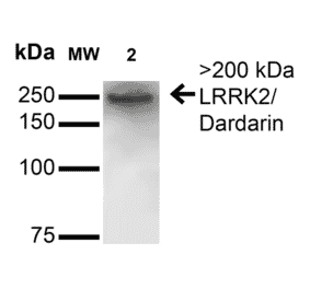 Western Blot - Anti-LRRK2 Antibody [S231B-34] (A305152) - Antibodies.com