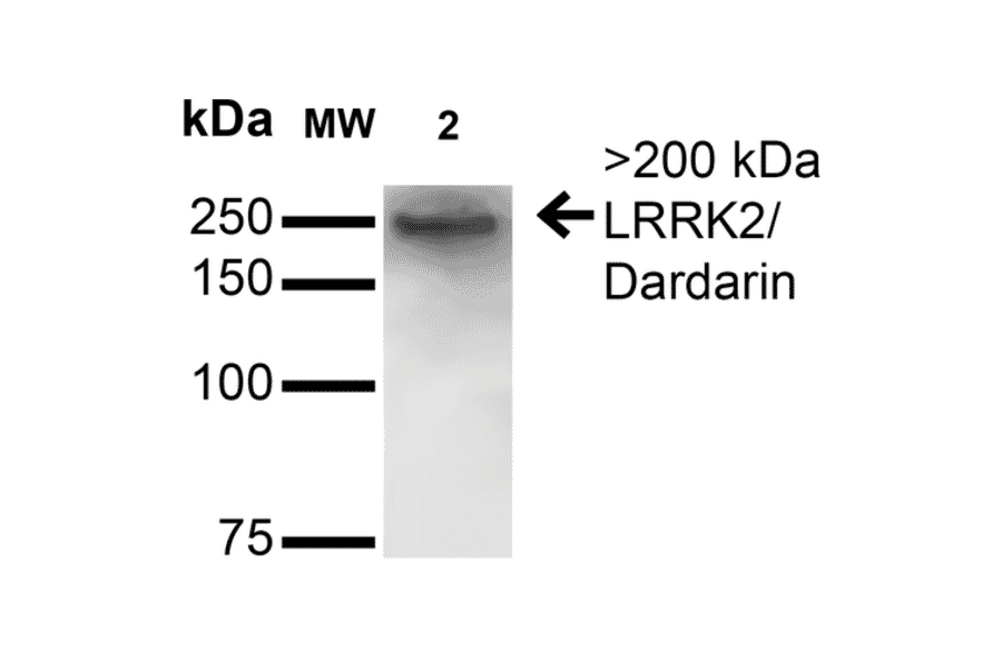 Western Blot - Anti-LRRK2 Antibody [S231B-34] (A305152) - Antibodies.com