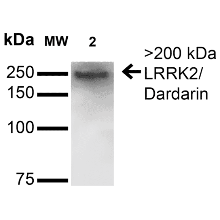 Western Blot - Anti-LRRK2 Antibody [S231B-34] (A305152) - Antibodies.com