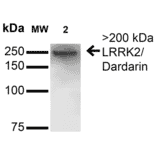 Western Blot - Anti-LRRK2 Antibody [S231B-34] (A305152) - Antibodies.com