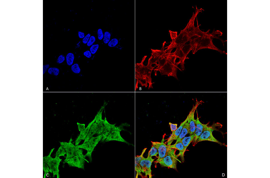 Immunocytochemistry/Immunofluorescence - Anti-LRRK2 Antibody [S231B-34] (A305152) - Antibodies.com