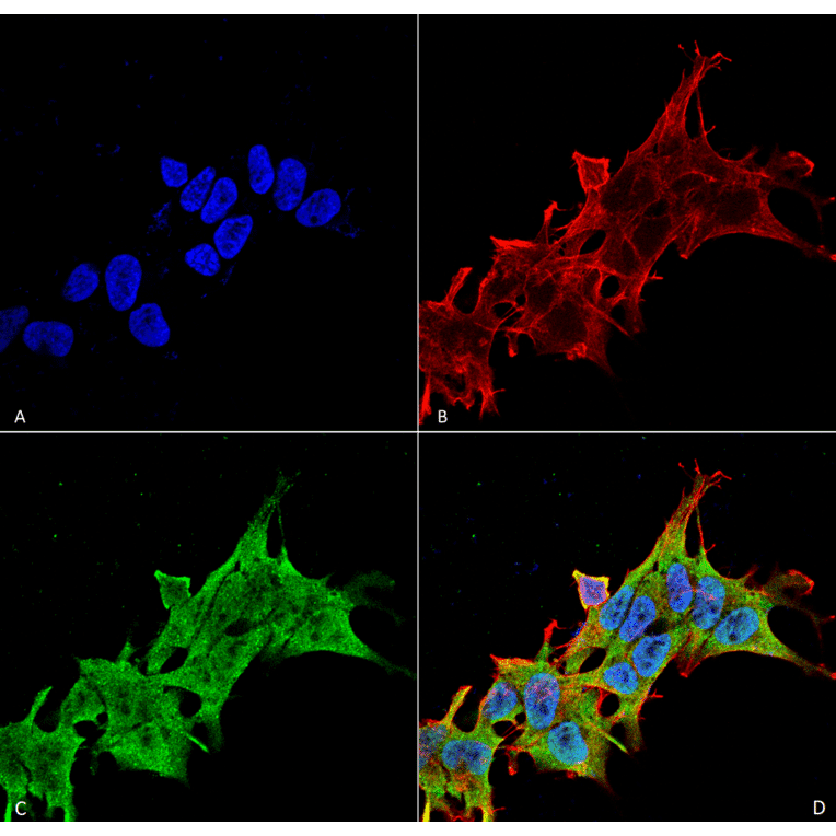 Immunocytochemistry/Immunofluorescence - Anti-LRRK2 Antibody [S231B-34] (A305152) - Antibodies.com