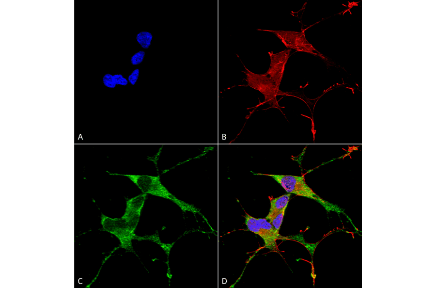 Immunocytochemistry/Immunofluorescence - Anti-LRRK2 Antibody [S231B-34] (A305152) - Antibodies.com