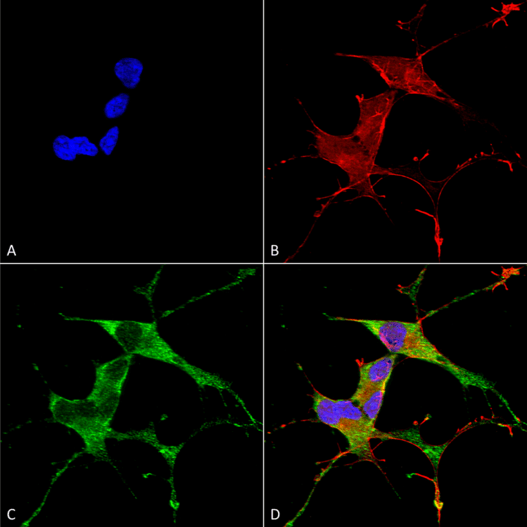 Immunocytochemistry/Immunofluorescence - Anti-LRRK2 Antibody [S231B-34] (A305152) - Antibodies.com