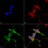 Immunocytochemistry/Immunofluorescence - Anti-LRRK2 Antibody [S231B-34] (A305152) - Antibodies.com