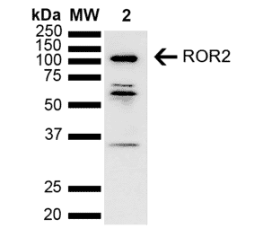Western Blot - Anti-ROR2 Antibody (A305153) - Antibodies.com