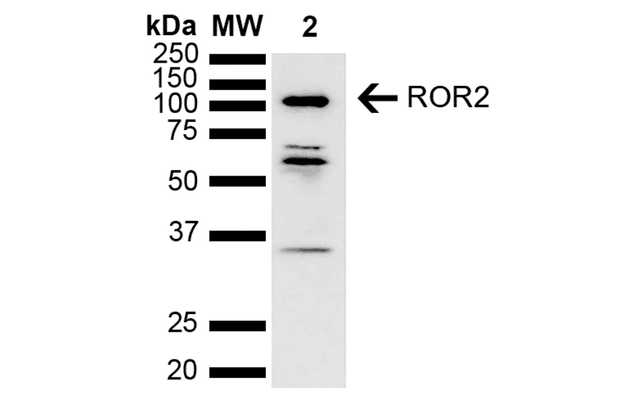 Western Blot - Anti-ROR2 Antibody (A305153) - Antibodies.com