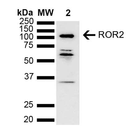 Western Blot - Anti-ROR2 Antibody (A305153) - Antibodies.com