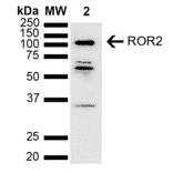 Western Blot - Anti-ROR2 Antibody (A305153) - Antibodies.com