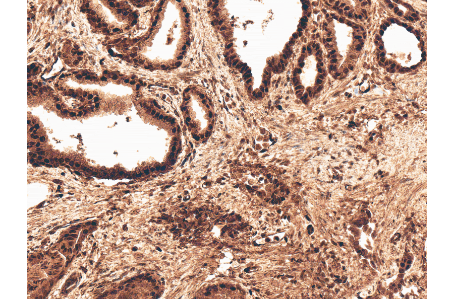 Immunohistochemistry - Anti-ROR2 Antibody (A305153) - Antibodies.com