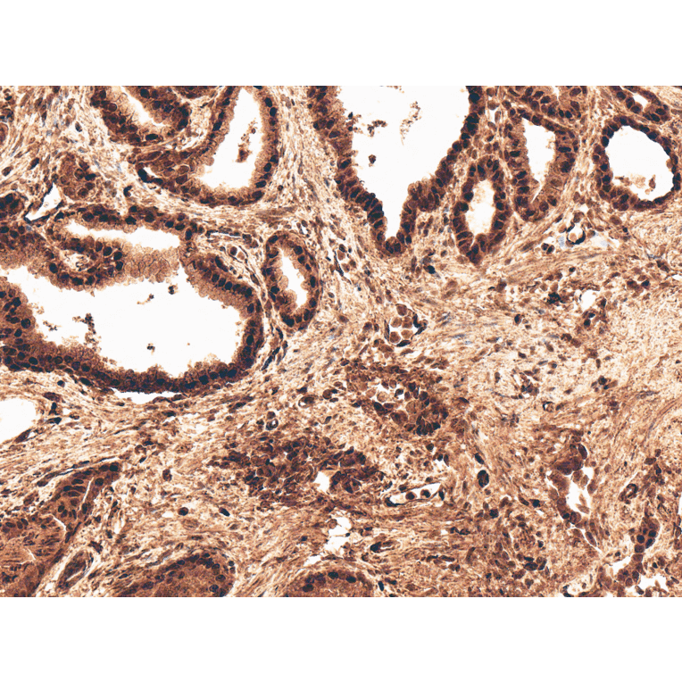 Immunohistochemistry - Anti-ROR2 Antibody (A305153) - Antibodies.com