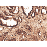 Immunohistochemistry - Anti-ROR2 Antibody (A305153) - Antibodies.com