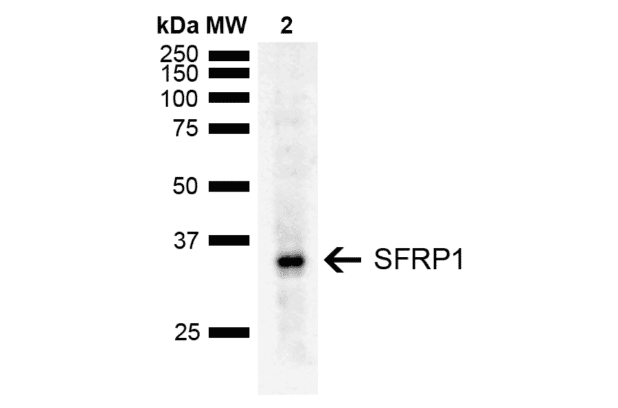 Western Blot - Anti-SFRP1 Antibody (A305154) - Antibodies.com