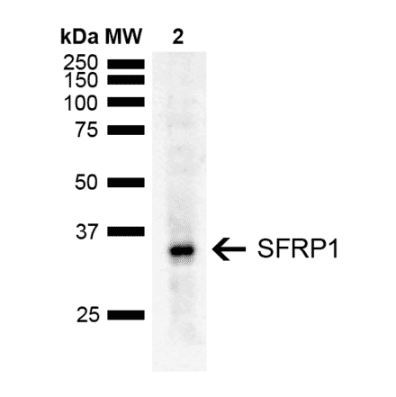 Western Blot - Anti-SFRP1 Antibody (A305154) - Antibodies.com
