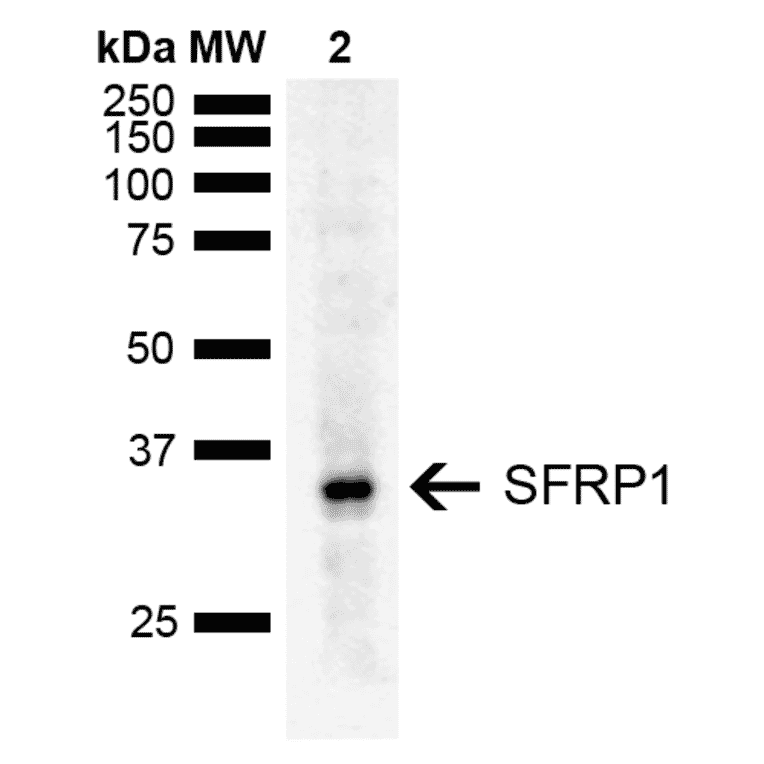 Western Blot - Anti-SFRP1 Antibody (A305154) - Antibodies.com