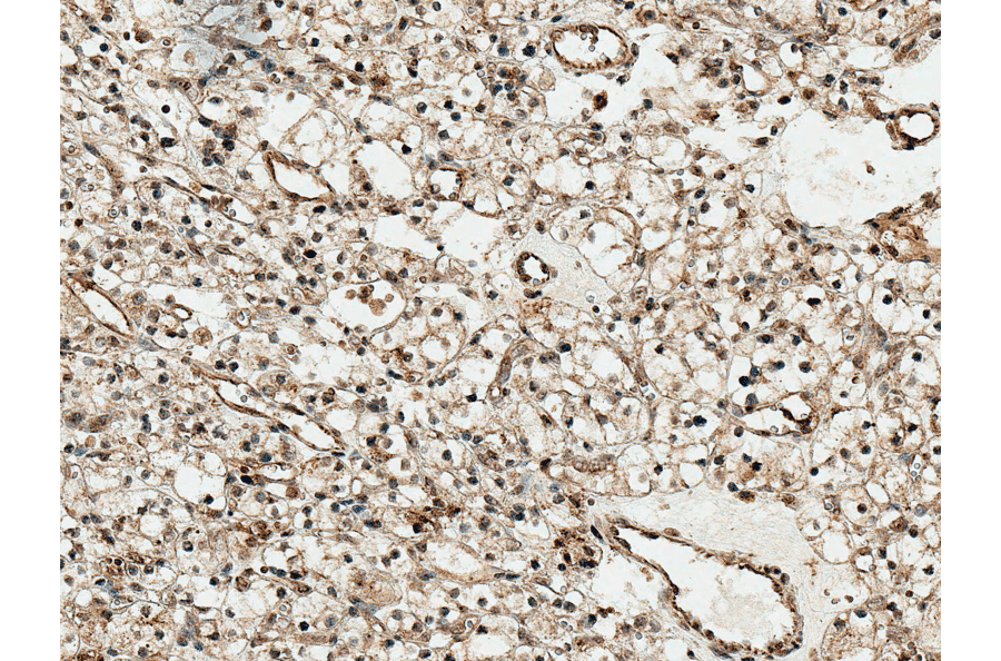 Immunohistochemistry - Anti-SFRP1 Antibody (A305154) - Antibodies.com