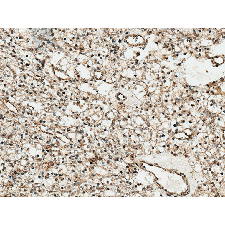 Immunohistochemistry - Anti-SFRP1 Antibody (A305154) - Antibodies.com