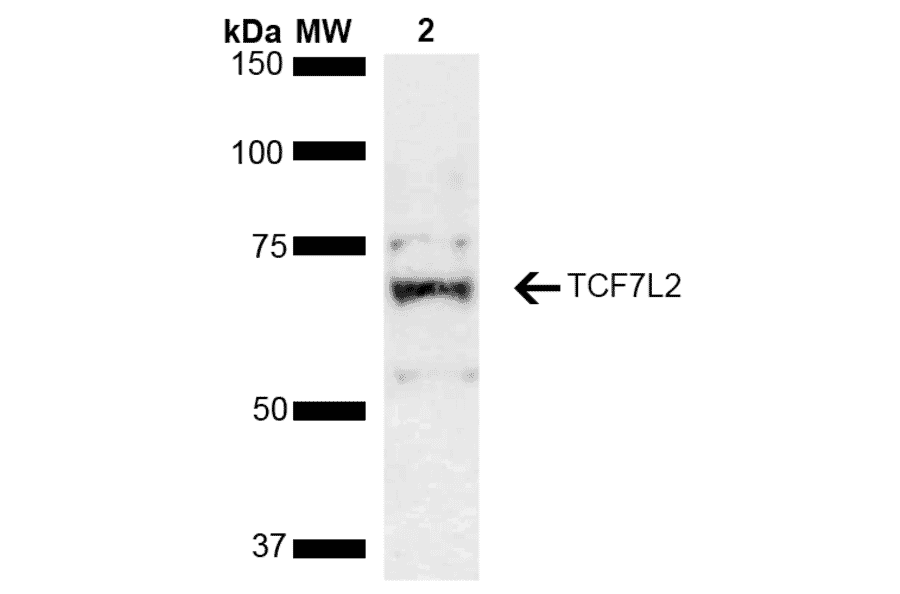 Western Blot - Anti-TCF-4 / TCF7L2 Antibody (A305158) - Antibodies.com