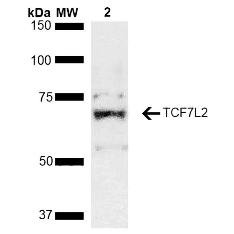 Western Blot - Anti-TCF-4 / TCF7L2 Antibody (A305158) - Antibodies.com